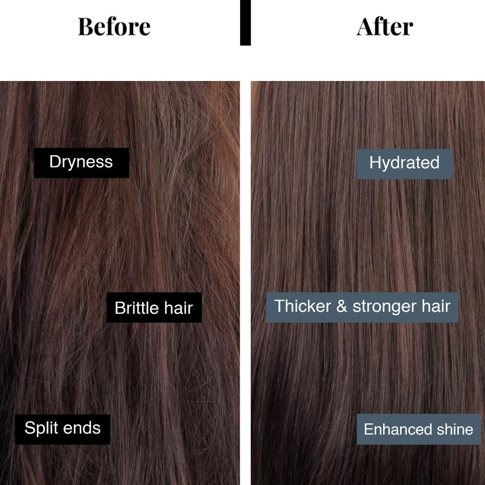 Bare Anatomy Anti Hair Fall Shampoo | 5x Hair Fall Control & Growth|Contains Biotin Adenosine, & Peptides | Rosemary, Rice Water, Hyaluronic Acid | For All Hair Types | For Women & Men | 250ml - Image 2